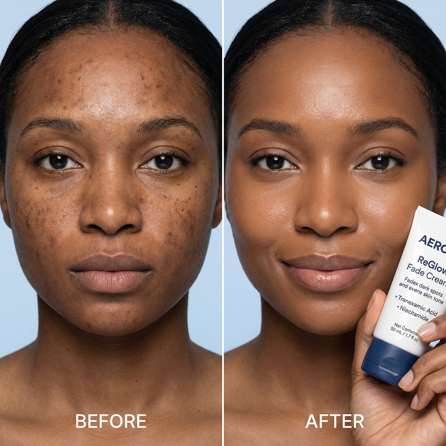 Aerora™ ReGlow Fade Cream