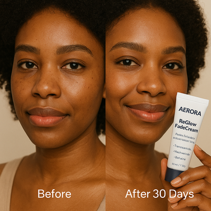 Aerora™ ReGlow Fade Cream