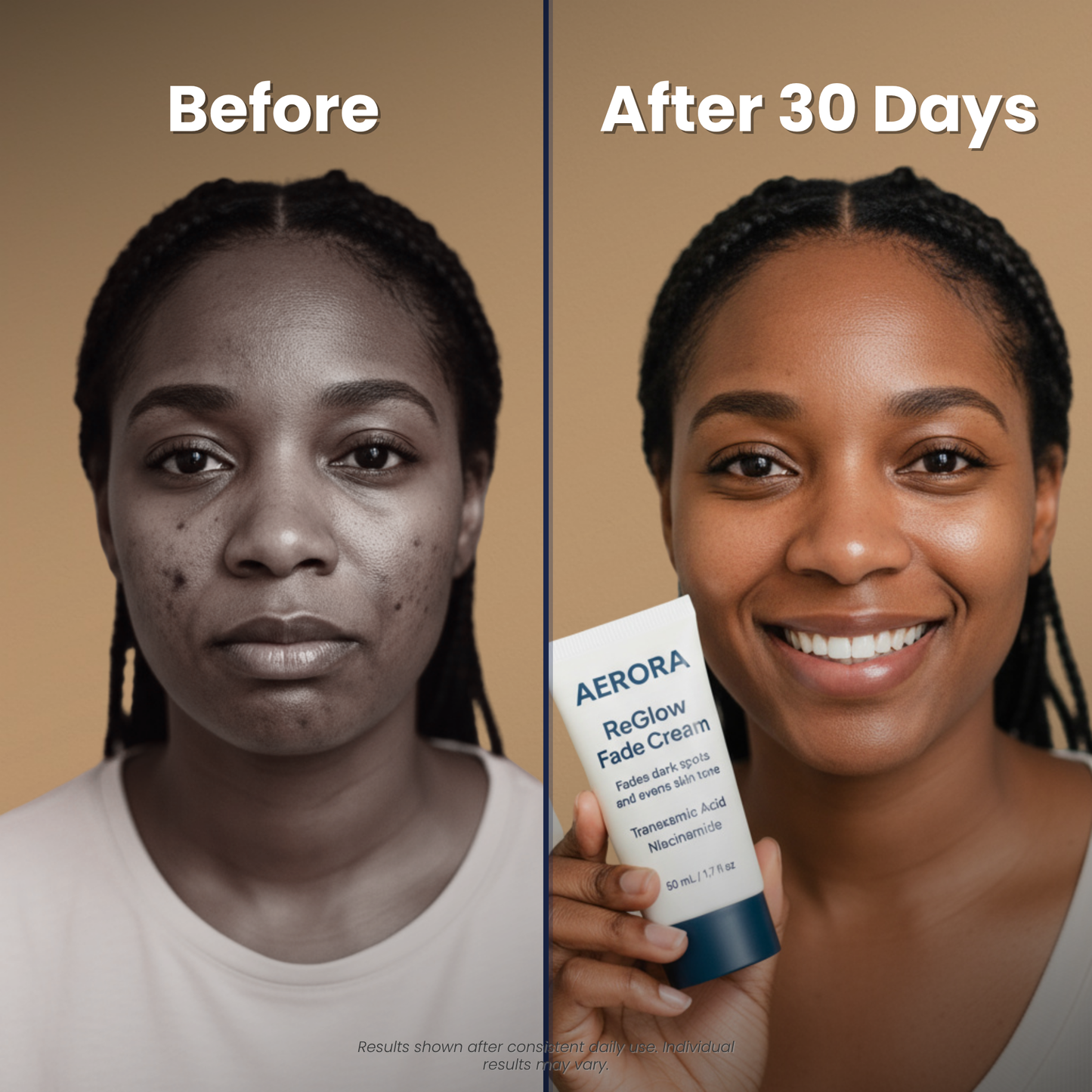 Aerora™ ReGlow Fade Cream
